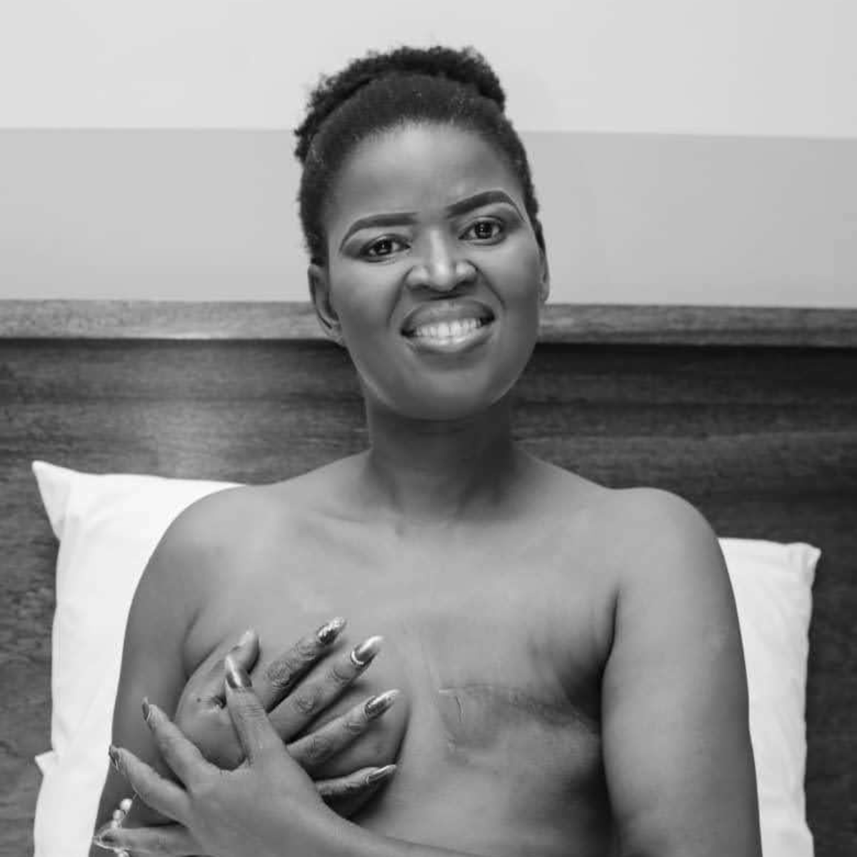 Betty Mbaembae chooses to reveal her mastectomy scar—a powerful symbol of her victory and a testament to the life she continues to embrace.